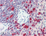Caspase-3 polyclonal antibody Immunohistochemistry