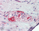 Mcl-1 polyclonal antibody Immunohistochemistry