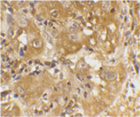 Bim/BOD polyclonal antibody Immunohistochemistry