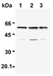 TRAF6 polyclonal antibody Western blot