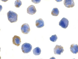 c-FLIP polyclonal antibody Immunocytochemistry