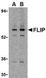 c-FLIP polyclonal antibody Western blot