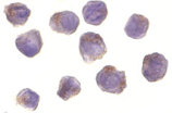 RICK polyclonal antibody Immunocytochemistry