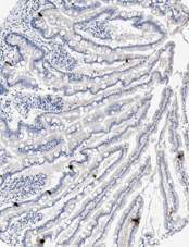 Peptide YY (human) monoclonal antibody (1) Immunohistochemistry
