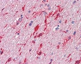 HGF/SF monoclonal antibody (7-2) Immunohistochemistry