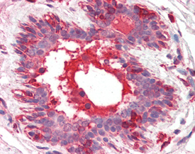 HGF/SF monoclonal antibody (7-2) Immunohistochemistry