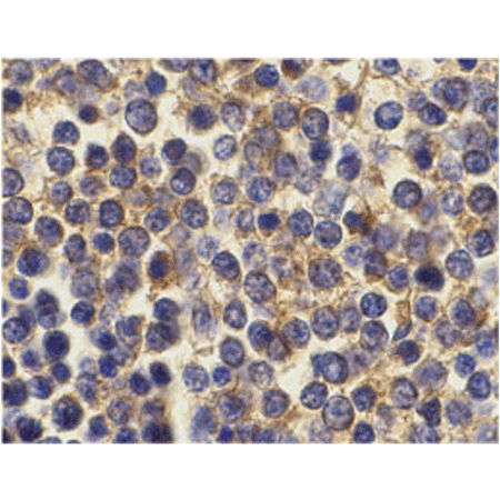 BCMA polyclonal antibody Immunohistochemistry