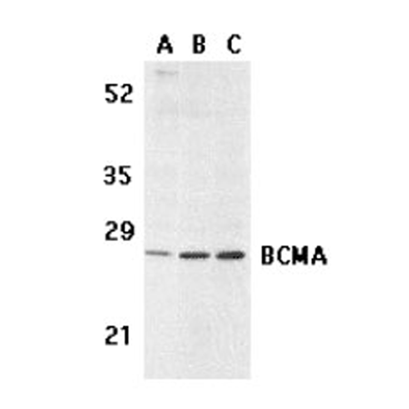 BCMA polyclonal antibody Western blot