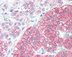 Src monoclonal antibody (5A18) Immunohistochemistry