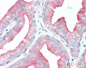 Src monoclonal antibody (5A18) Immunohistochemistry