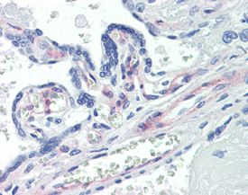 PDGF receptor β monoclonal antibody (42G12) Immunohistochemistry