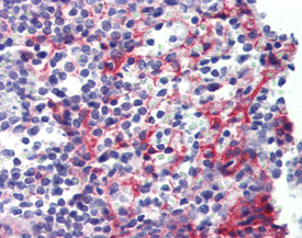 PDGF receptor β monoclonal antibody (42G12) Immunohistochemistry