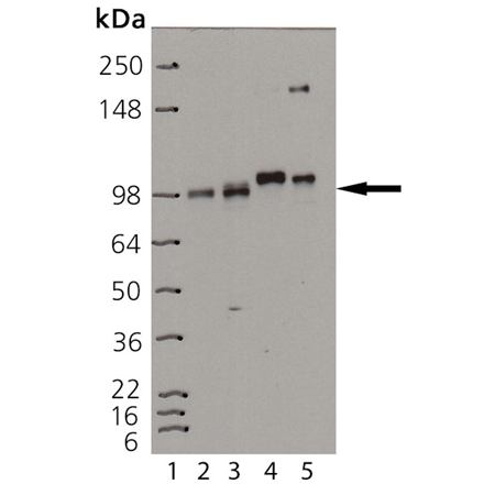 Insulin receptor β monoclonal antibody (C18C4) Western blot