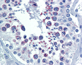 Smac/DIABLO monoclonal antibody (79-1-83) Immunohistochemistry