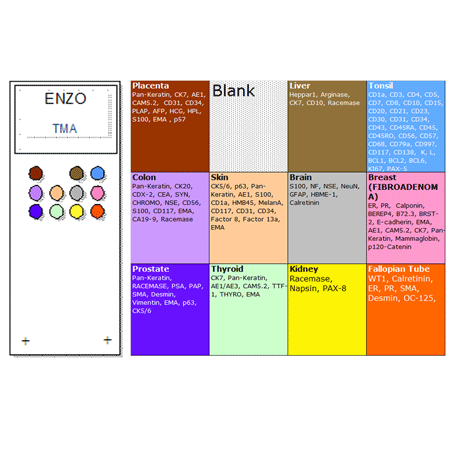 MULTIVIEW® Universal Tissue Microarray schematic