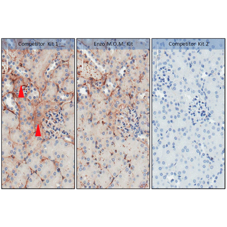 POLYVIEW® (mouse on mouse-HRP) IHC kit Immunohistochemistry