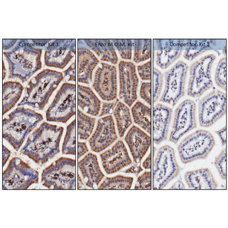 POLYVIEW® (mouse on mouse-HRP) IHC kit Immunohistochemistry