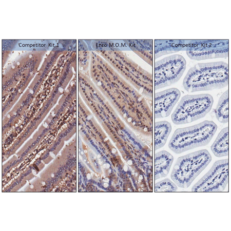 POLYVIEW® (mouse on mouse-HRP) IHC kit Immunohistochemistry