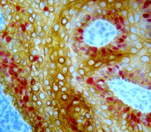 HIGHDEF® red IHC chromogen (AP) Immunohistochemistry