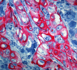HIGHDEF® red IHC chromogen (AP, plus) Immunohistochemistry