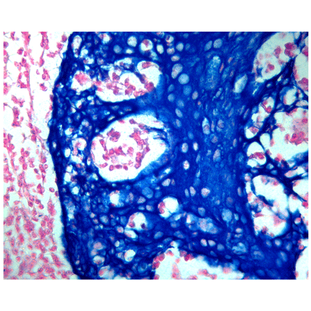 HIGHDEF® blue IHC chromogen (HRP) Immunohistochemistry