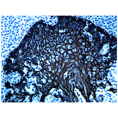HIGHDEF black IHC chromogen (HRP) Immunohistochemistry human tonsil HMWCK