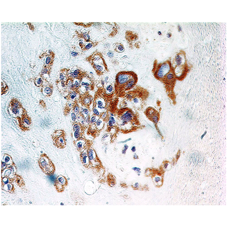 A20 monoclonal antibody (59A426) Immunohistochemistry
