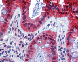 Caspase-7 monoclonal antibody (7-1-11) Immunohistochemistry