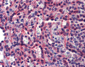 Caspase-7 monoclonal antibody (7-1-11) Immunohistochemistry