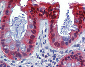 Caspase-7 monoclonal antibody (10-1-62) Immunohistochemistry