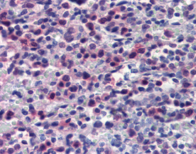 Caspase-7 monoclonal antibody (10-1-62) Immunohistochemistry