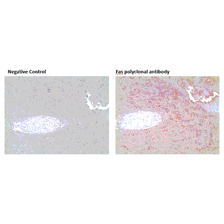 Fas polyclonal antibody Immunohistochemistry spleen