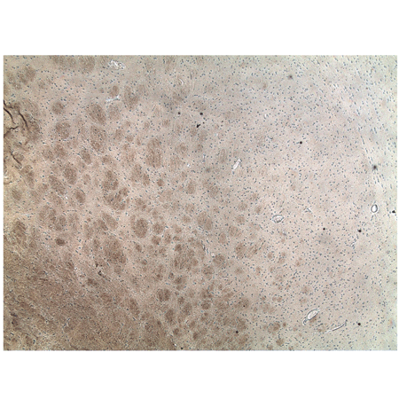 Agrin monoclonal antibody (Agr-131) Immunohistochemistry