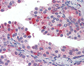 TAP1 polyclonal antibody Immunohistochemistry