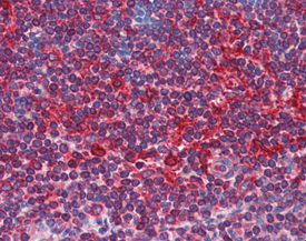 TAP1 polyclonal antibody Immunohistochemistry