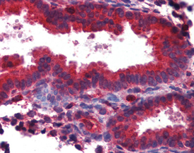 TAP1 polyclonal antibody Immunohistochemistry