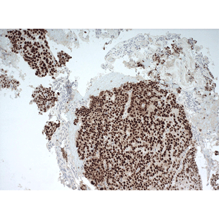 p53 monoclonal antibody (PAb122) Immunohistochemistry