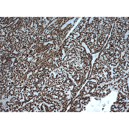 p53 monoclonal antibody (PAb122) Immunohistochemistry