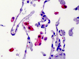 CaMKII polyclonal antibody Immunohistochemistry