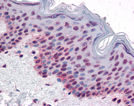 [pThr232]Aurora B polyclonal antibody Immunohistochemistry
