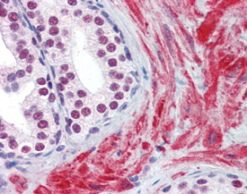 eIF2 α polyclonal antibody Immunohistochemistry