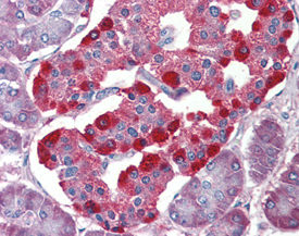 eIF4E-BP2 polyclonal antibody Immunohistochemistry