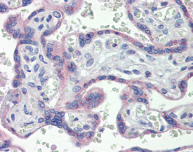eNOS polyclonal antibody Immunohistochemistry