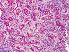 eNOS polyclonal antibody Immunohistochemistry