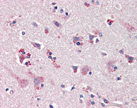 nNOS polyclonal antibody Immunohistochemistry