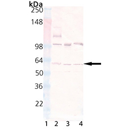 Akt polyclonal antibody Western blot