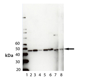 PDK1 polyclonal antibody Western blot