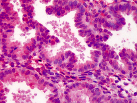MEKK3 polyclonal antibody Immunohistochemistry