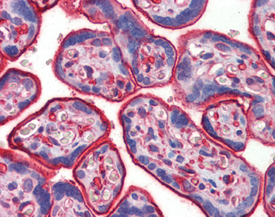 TAK1 polyclonal antibody Immunohistochemistry