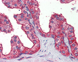 TAK1 polyclonal antibody Immunohistochemistry